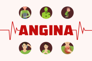 Symptoms of Angina | Angina Awareness India